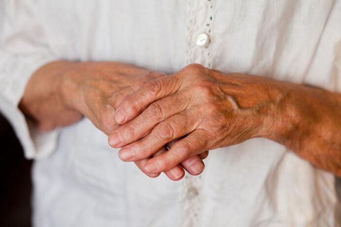 Les douleurs dans les articulations des mains dérangent souvent les personnes âgées. 