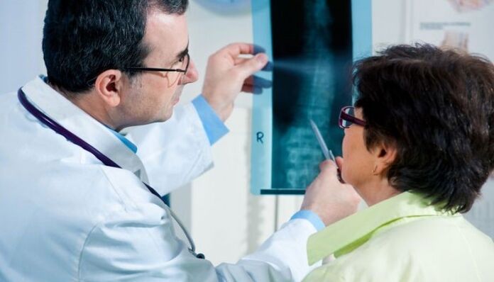 La radiographie comme méthode de diagnostic de l'ostéochondrose cervicale.